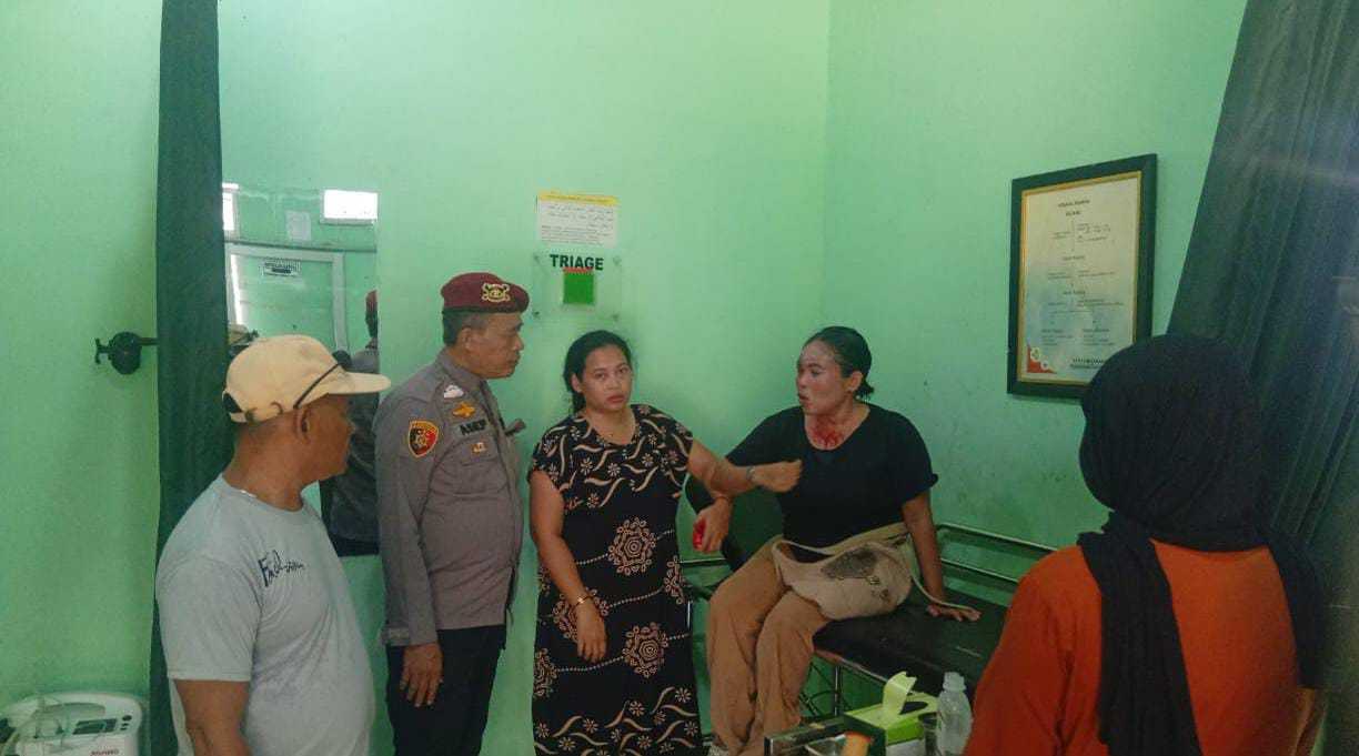 Cekcok Soal Pungutan, Emak-emak Bonyok Dibogem Preman di Pantai Santolo Garut